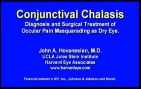 Understanding Conjunctival Chalasis